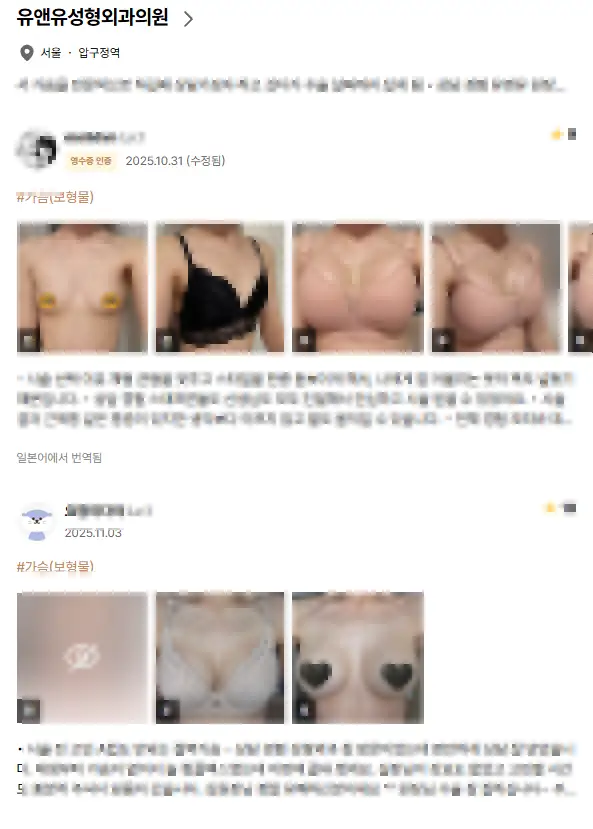 仁川隆乳,不想在 5 年內取出義乳的話該知道的 2 件事 — 內文圖片 3