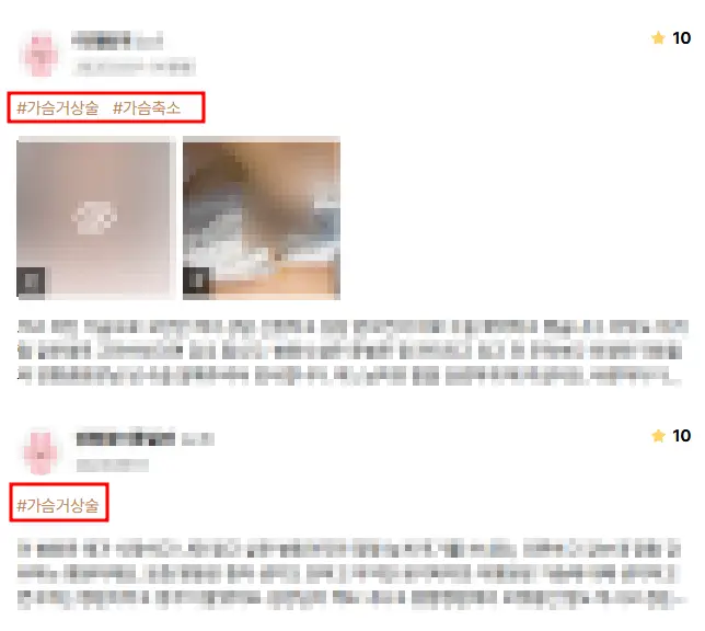 乳房下垂手術費用,以及需要提乳/義乳的情況也為您整理說明。<根據20年研究經驗提供的建議> — 內文圖片 7