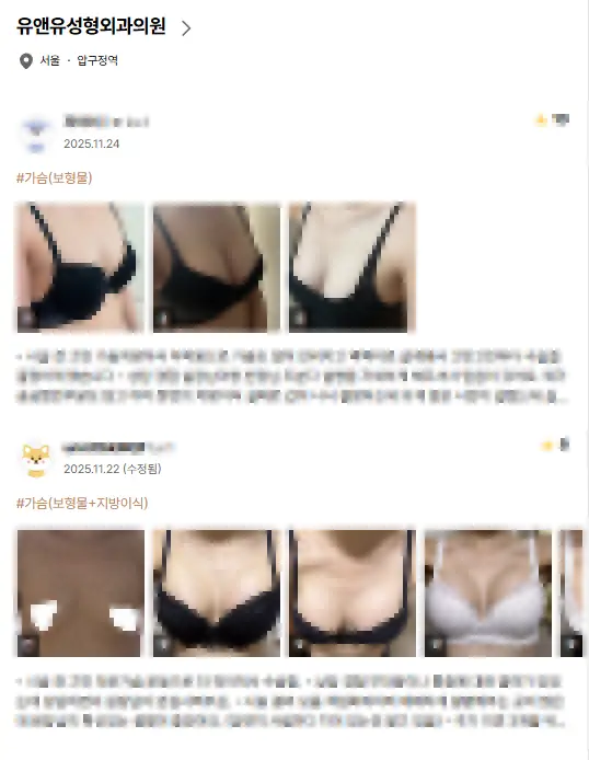 隆乳醫療機構？為了不被評價騙倒，您必須知道的 2 件事。〈20 年研究經驗的建議〉 — 內文圖片 2