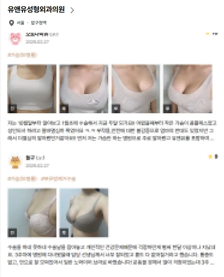 乳房提乳手術費用？先查價格其實沒什麼意義。 — 內文圖片 5