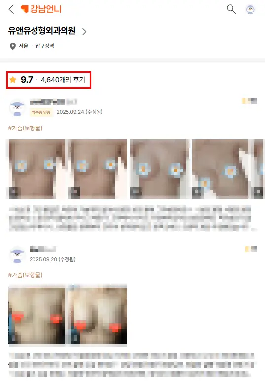 義乳破裂,一定要照 MRI 嗎?用超音波不能檢查嗎 — 內文圖片 2