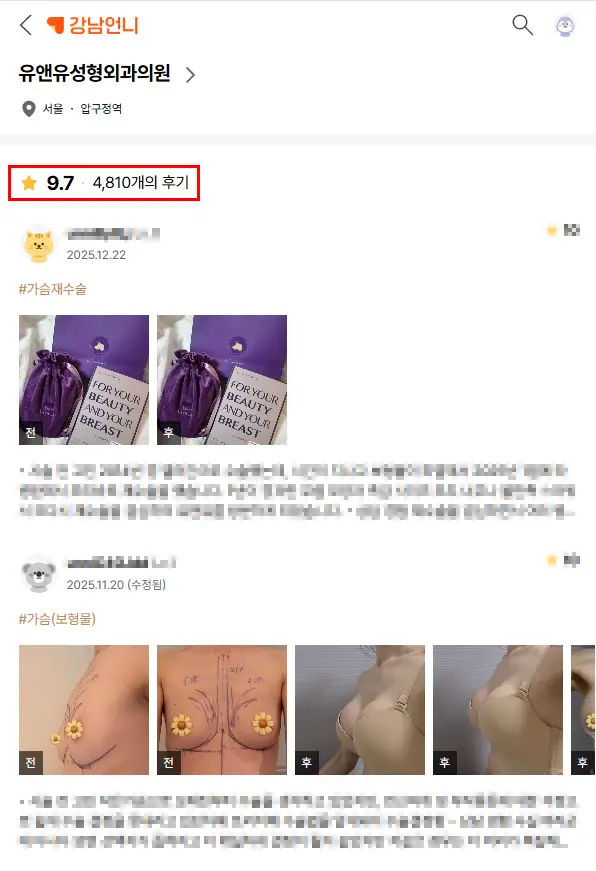 雞胸手術,隆乳後會不會只變大,卻沒有乳溝?<根據20年研究經驗提供的建議> — 內文圖片 2