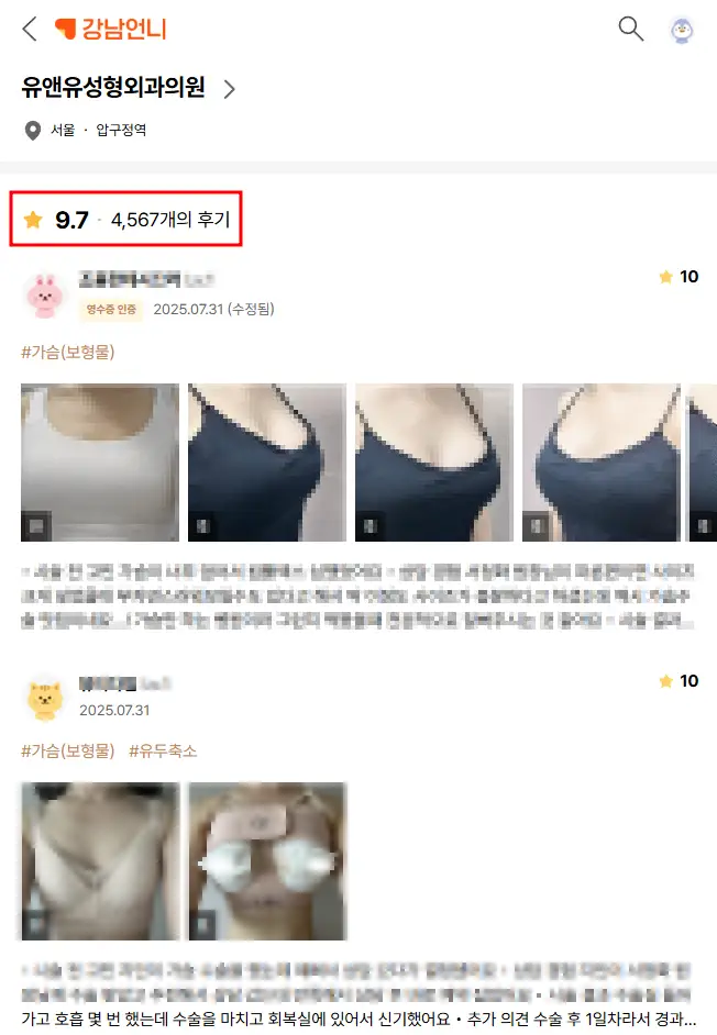 隆乳的種類，脂肪移植／幹細胞／義乳？該選哪一種〈來自 20 年研究經驗的建議〉 — 內文圖片 2
