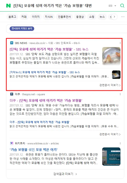 乳房手術與哺乳？隆乳、縮乳、提乳，各術式完整整理〈來自設有乳房外科專科醫師的診所的建議〉 — 內文圖片 10