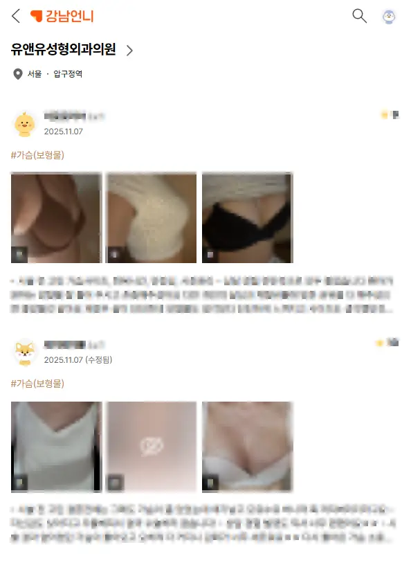 乳房不對稱矯正?用義乳隆乳能把不對稱調整過來嗎?〈從 402 人的研究案例看注意事項〉 — 內文圖片 6