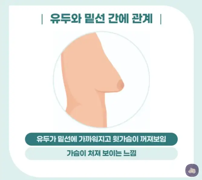 提乳術的費用與價格?由光是去年就進行 3023 例乳房義乳手術的診所來回答。 — 內文圖片 5