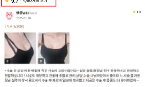 義乳取出？疼痛、恢復期與身體變化，我們用研究資料為您整理。 — 內文圖片 14