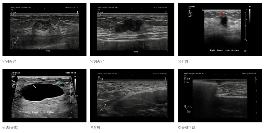 江南隆乳診所?去年完成3000件以上手術的診所建議關注的2項特點。 — 內文圖片 14