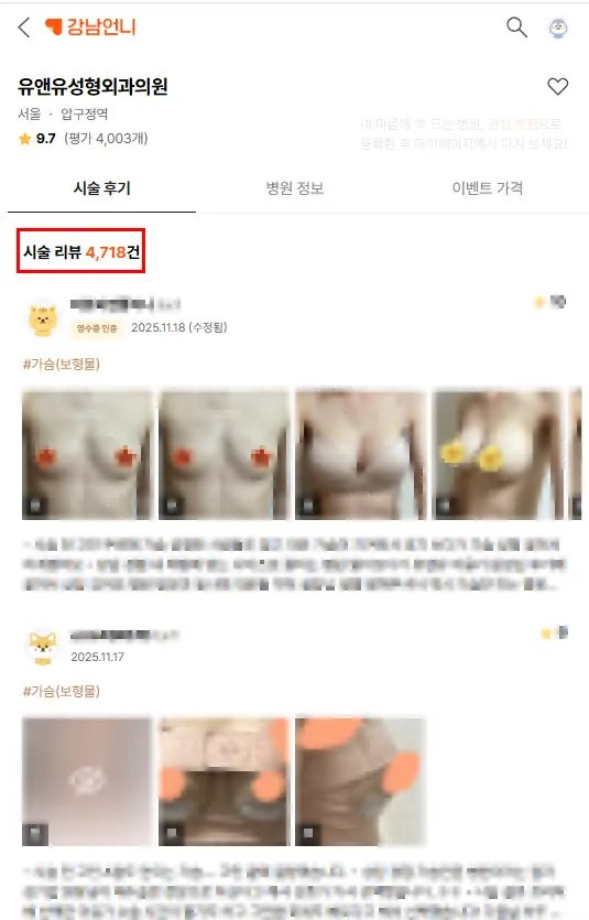 隆乳後內衣要穿多久？連上胸帶都自行開發的醫療機構給您的建議。 — 內文圖片 3