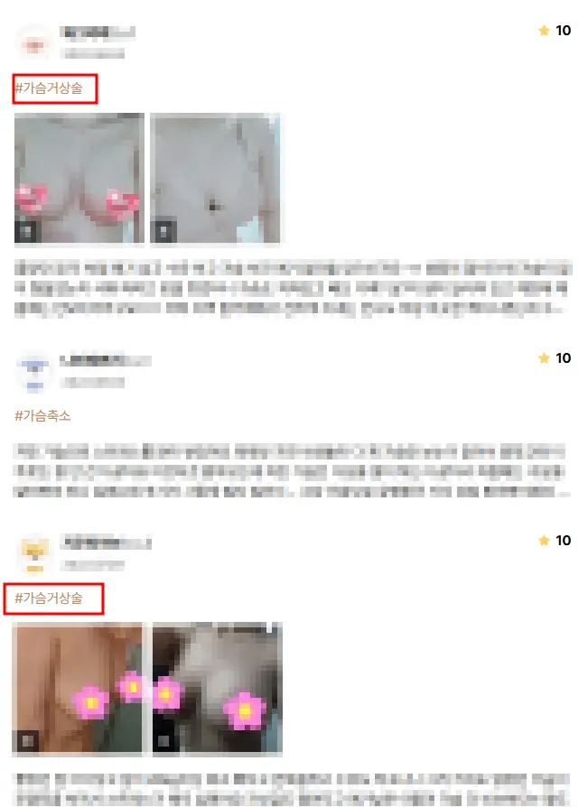 乳房下垂手術費用,以及需要提乳/義乳的情況也為您整理說明。<根據20年研究經驗提供的建議> — 內文圖片 9