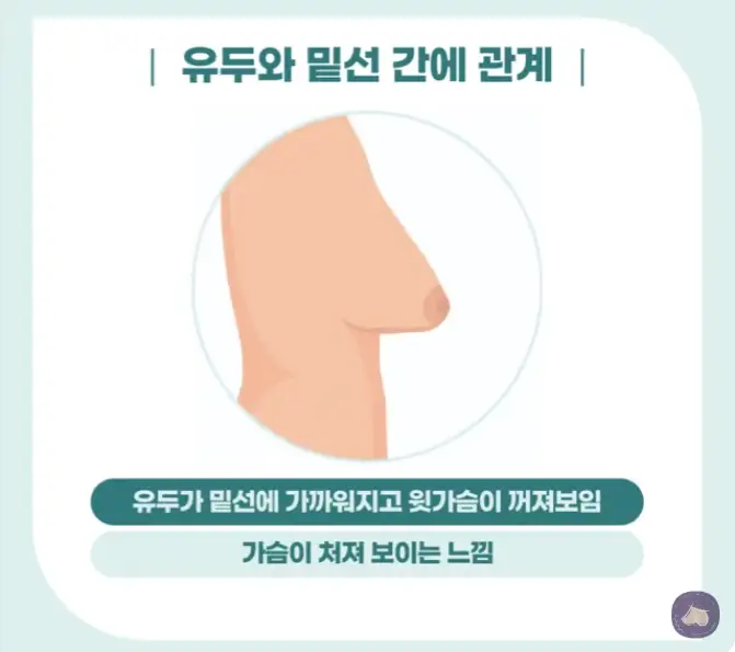 乳房下垂手術費用？請別被心得文騙了。 — 內文圖片 4