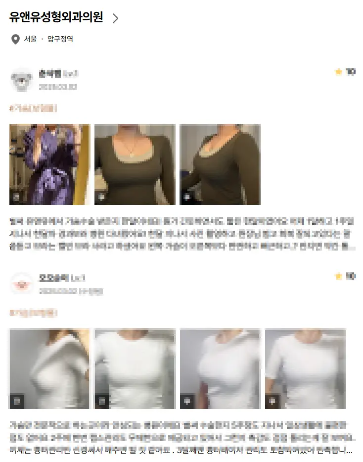 乳房提乳手術費用？先查價格其實沒什麼意義。 — 內文圖片 7