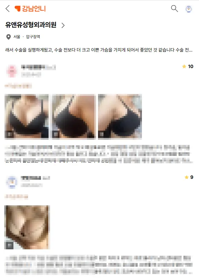 乳房手術後的下垂，放了義乳不是會垂得更嚴重嗎？ — 內文圖片 2