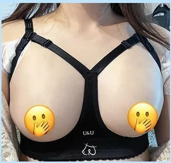 隆乳術後第2天穿著塑身內衣的正面照 1