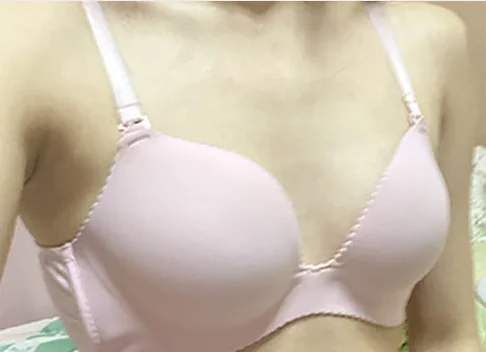 隆乳術前照片 2
