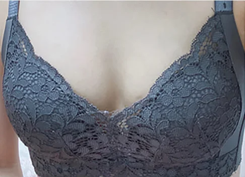 隆乳術前照片 5