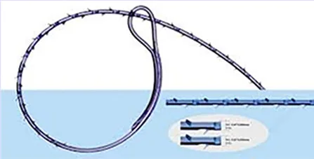 V-Loc縫線示意圖