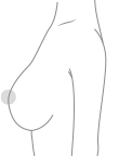 k5