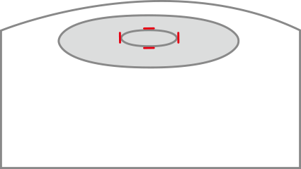 line1