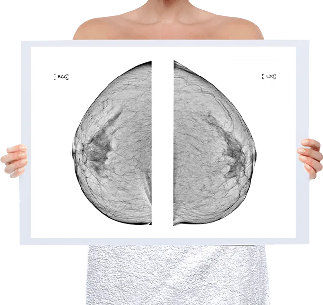 Healthy Breast乳房攝影img5 m